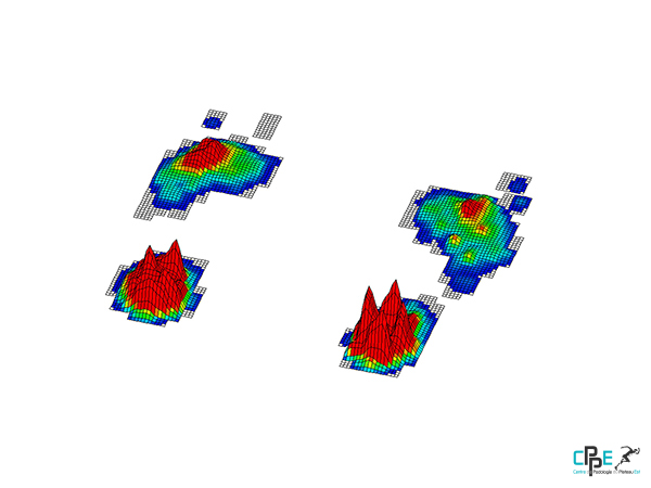 centre de podologie du plateau est-cppe76-bilan-podologique-podobarometrie