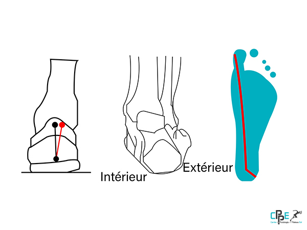 centre de podologie du plateau est-cppe76-bilan-podologique-shemas