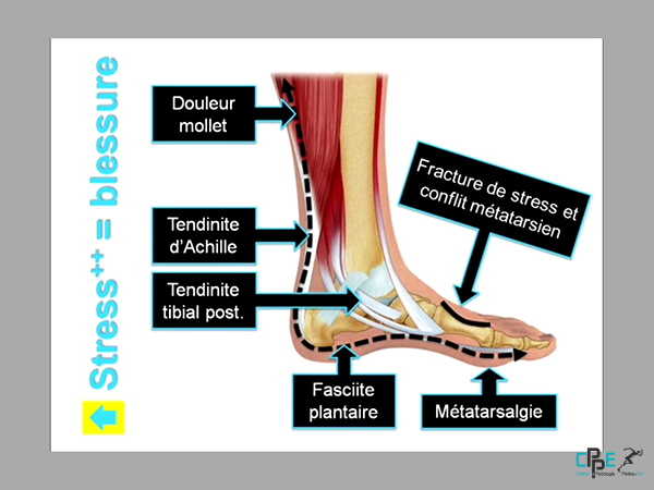 centre de podologie du plateau est-cppe76-clinique-coureur