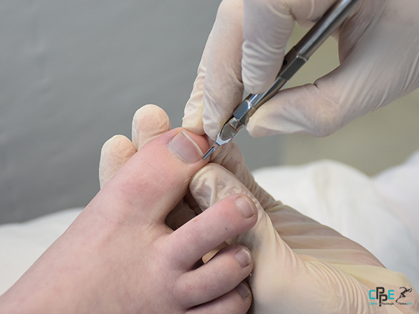 centre de podologie du plateau est-cppe76-soins-de-pédicurie